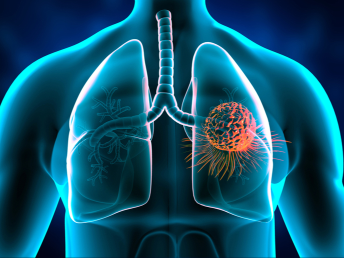 Que se passe-t-il lorsque le cancer du sein se propage aux poumons?