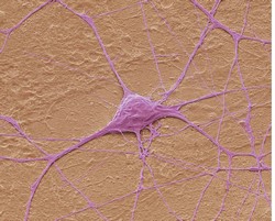 Estudio del transporte por axones en las neuronas motoras | AXOTRANSMAP  Project | Results in brief | FP7 | CORDIS | European Commission
