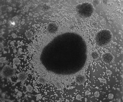 Los linfocitos T reguladores: un arma de doble filo | ITREGDIFFERENTIATION  Project | Results in brief | FP7 | CORDIS | European Commission